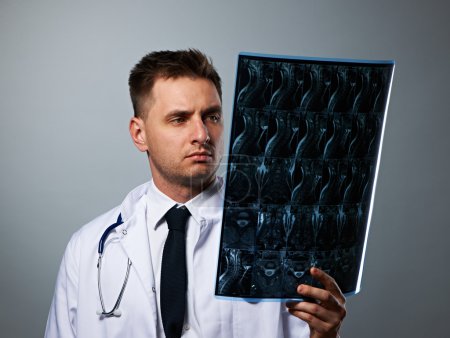 Medical doctor with MRI spinal scan