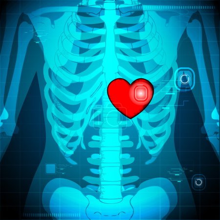 Human X Ray showing Heart