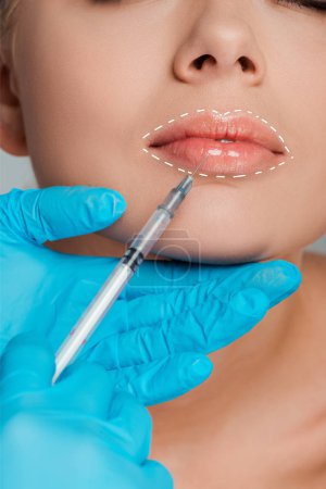 cropped view of beautician in latex gloves doing lip augmentation to woman
